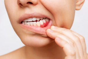 Sapphire Periodontics & Implant Dentistry | Protecting Your Smile From the Ground Up: A Patient-Friendly Guide to Periodontal Disease Management