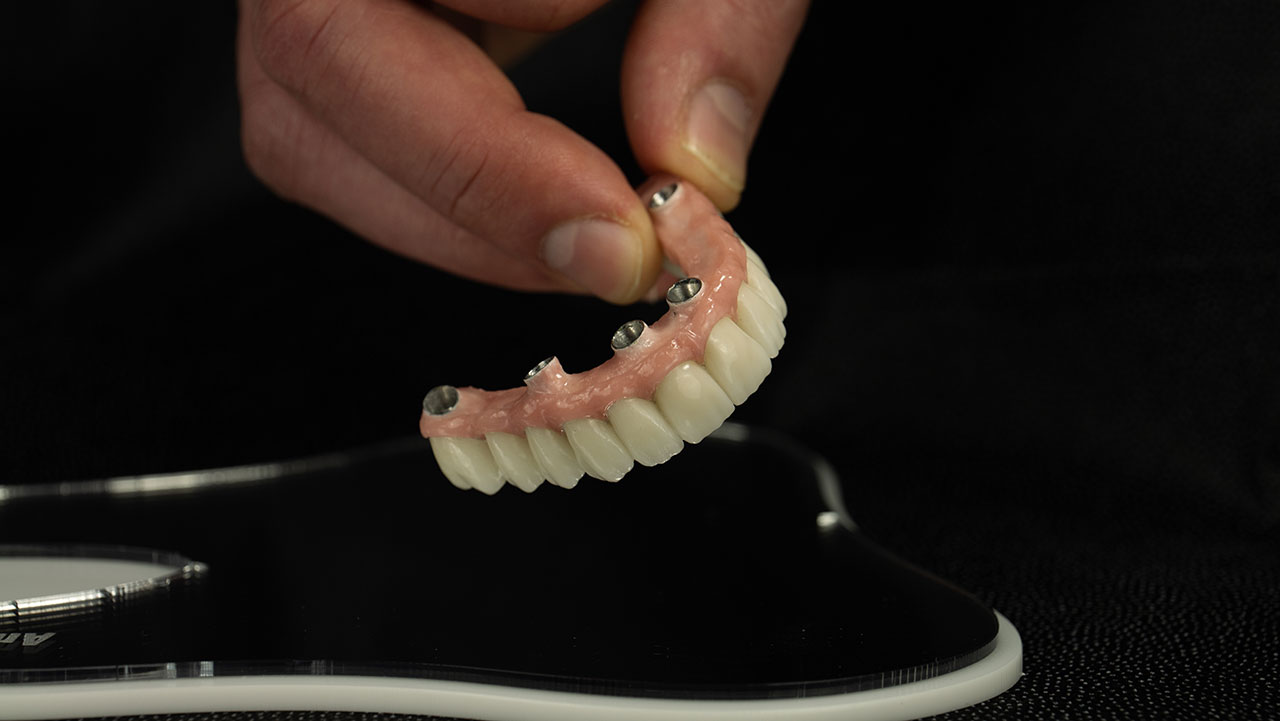 Sapphire Periodontics & Implant Dentistry | Snap Into a Stronger Smile: A Patient-Friendly Guide to Snap-in Dentures Sapphire Periodontics & Implant Dentistry | Snap Into a Stronger Smile: A Patient-Friendly Guide to Snap-in Dentures